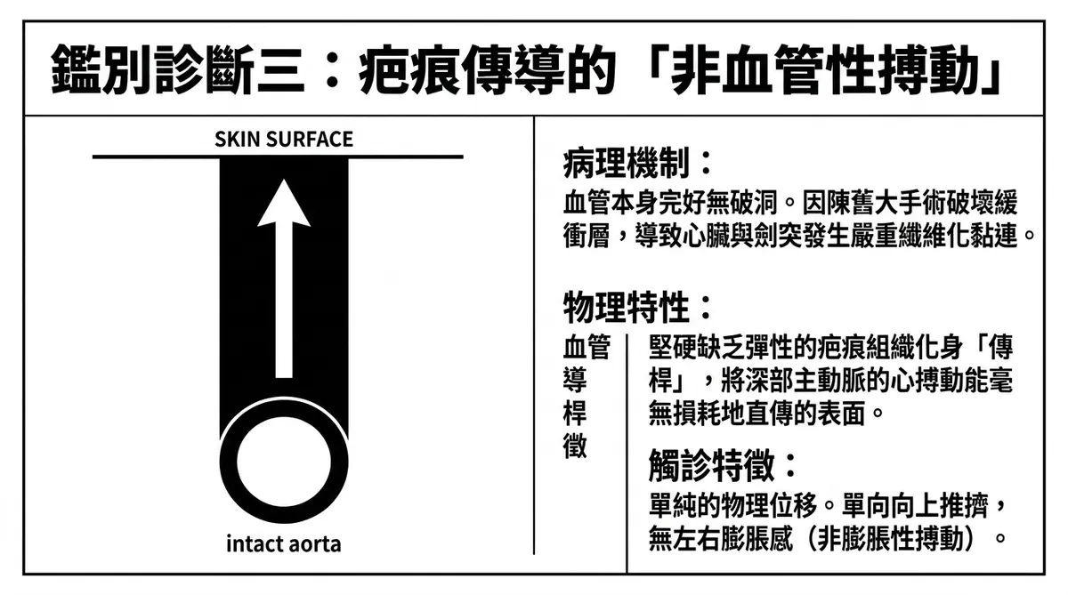 鑑別診斷三：疤痕傳導的非血管性搏動病理機制與理學觸診手感圖解
