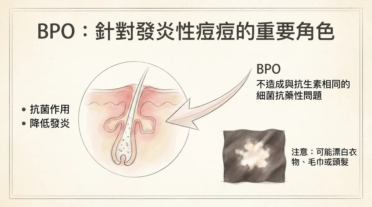 過氧化苯醯BPO治療青春痘:具抗菌與抗發炎作用、不易造成抗藥性,但可能漂白衣物與毛髮