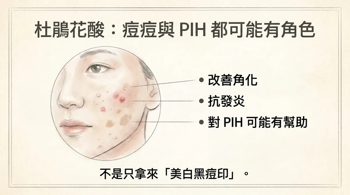 杜鵑花酸治療青春痘:可改善毛囊角化與發炎,並對發炎後色素沉著PIH可能有幫助
