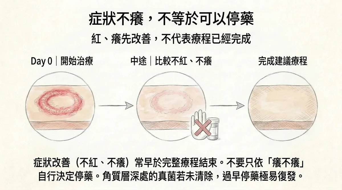 症狀不癢不等於可以停藥:開始治療、中途比較不紅不癢到完成建議療程歷程圖